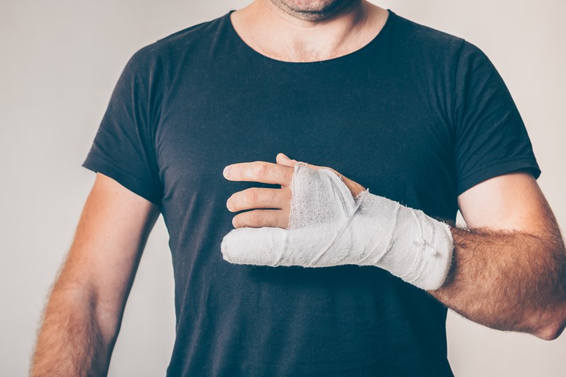 Wybity palec – objawy, rozpoznanie, czas leczenia